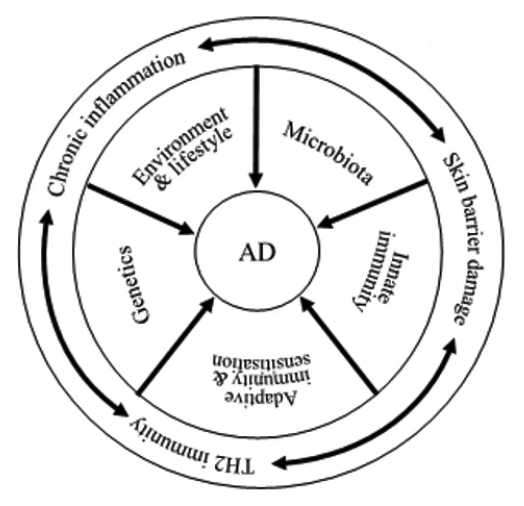 Redefining CAD (T Nuttall, WCVD, adapted from Eyerich et al, 2015)