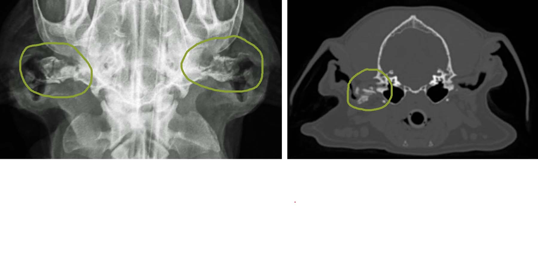 End-Stage Chronic Otitis Cases: Auricular Cartilage Ossification, XRay & CT Diagnoses