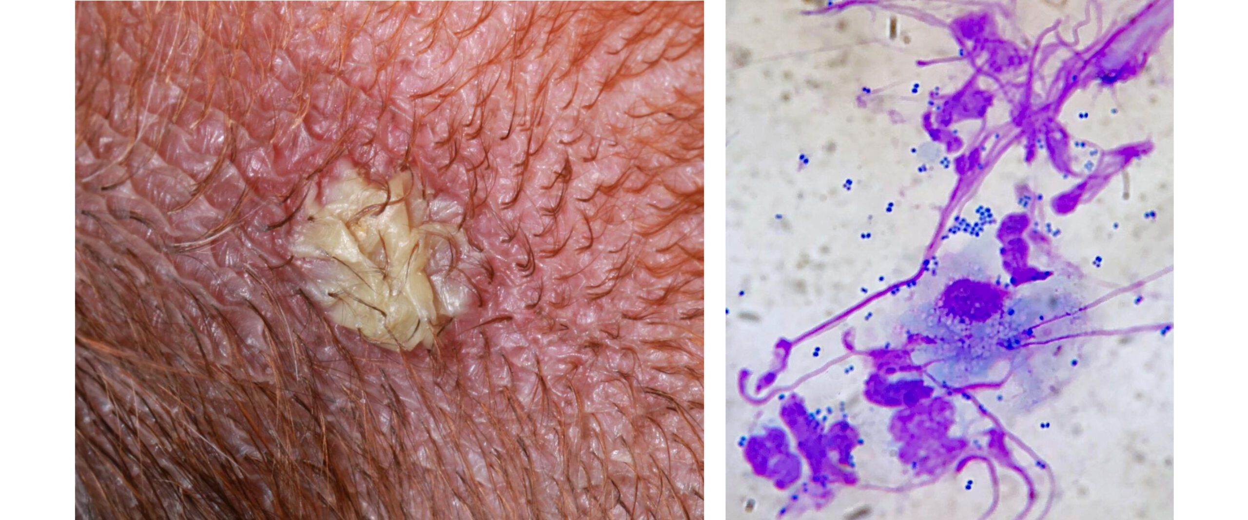 Superficial bacterial folliculitis deals dog home remedy