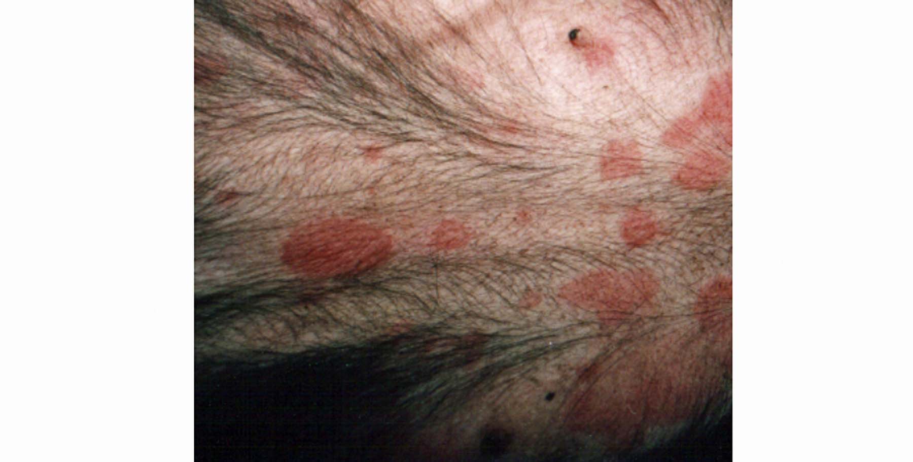 Canine Erythema Multiforme Minor