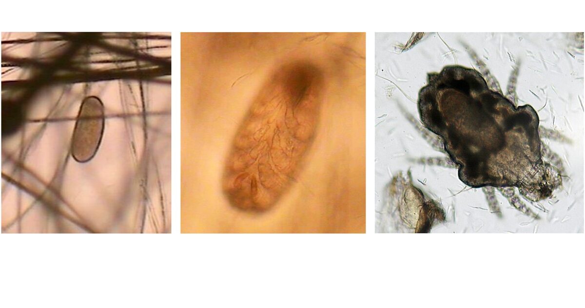 Cheyletiellosis (‘walking dandruff’): Cheyletiella yasguri adult Mite, Egg attached to hairshaft, Embryonated egg