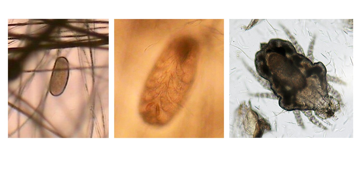 Cheyletiellosis (‘walking dandruff’): Cheyletiella yasguri adult Mite, Egg attached to hairshaft, Embryonated egg