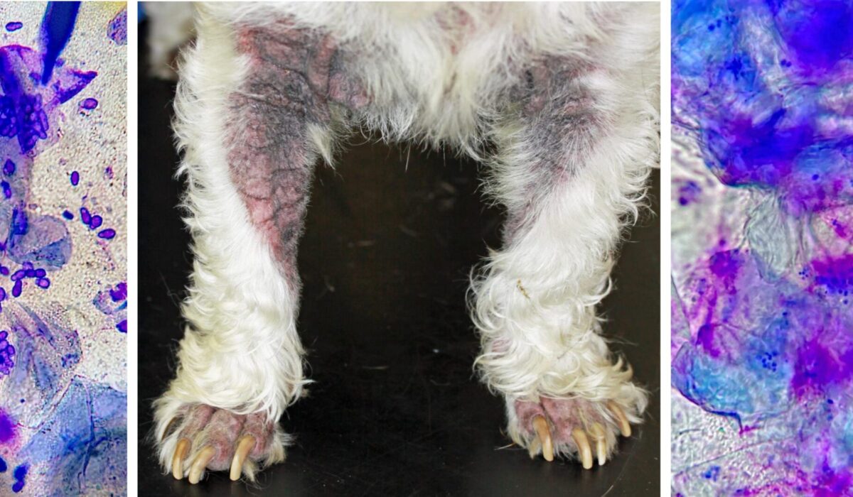 Chronic Atopic Dermatitis with Secondary Microbial Overgrowth: a simple, rapid Tape Strip allows Immediate Diagnosis & therefore Targetted Treatment