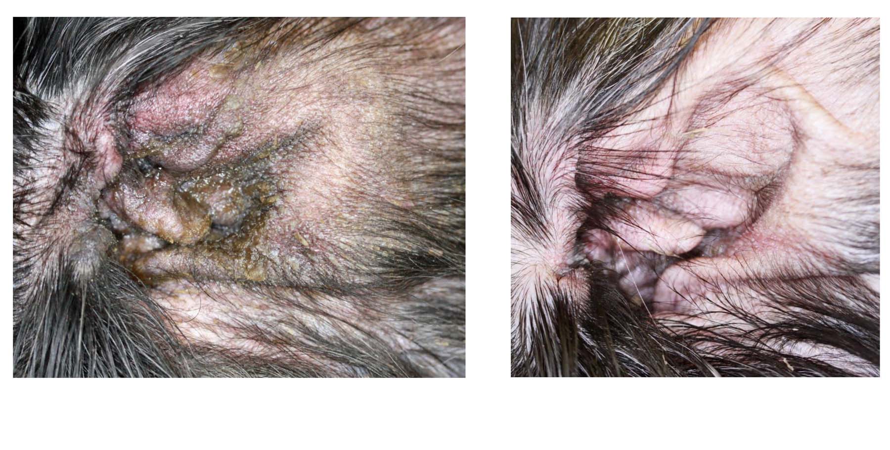 Chronic Pseudomonas Otitis: before & after Successful Treatment (with no Antibacterials)