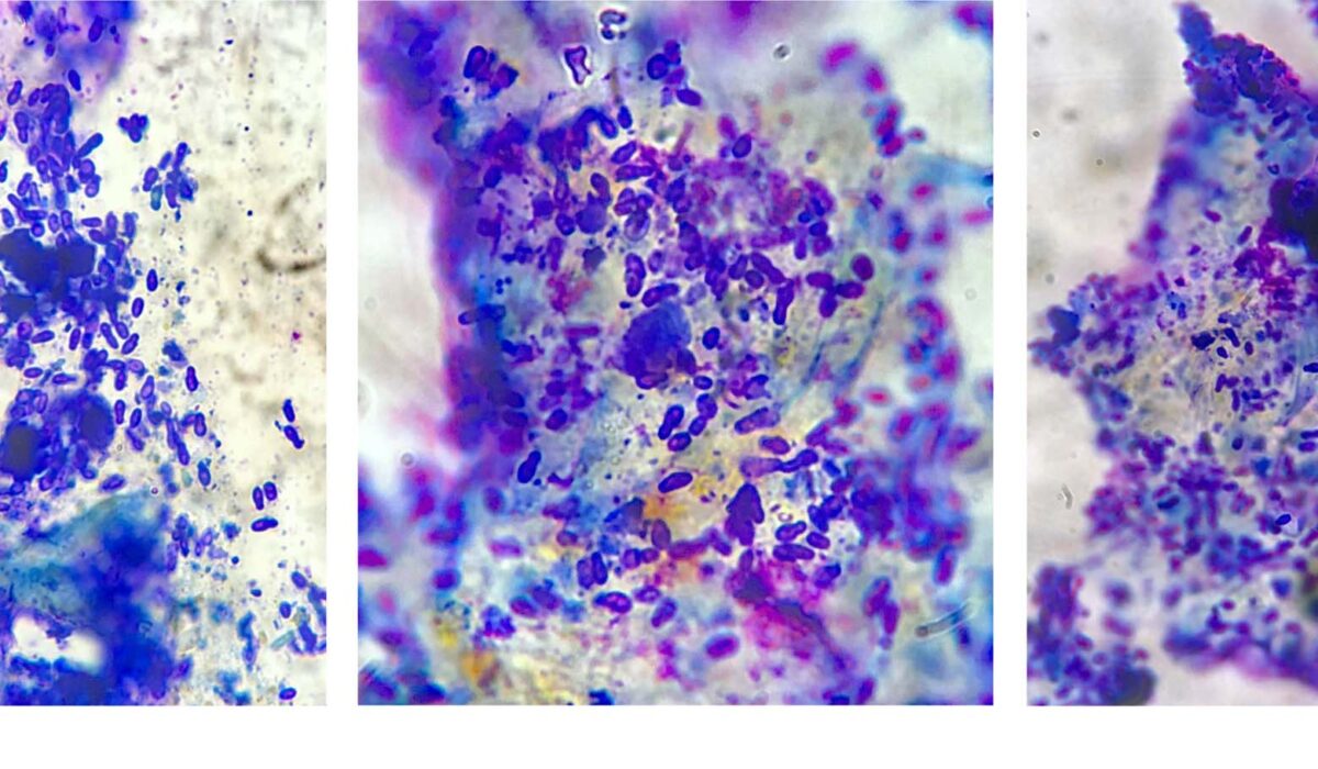 Feline Allergic Dermatitis with Malassezia Yeast Dysbiosis: immediate Cytology of Claw Bed