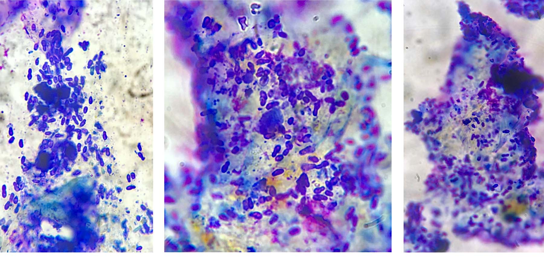 Feline Allergic Dermatitis with Malassezia Yeast Dysbiosis: immediate Cytology of Claw Bed