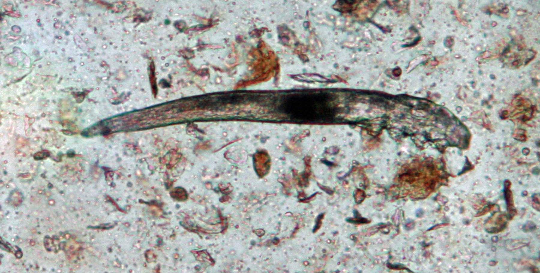 Demodectic Otitis: Demodex canis mite in an Ear Wax Smear, Labrador Retriever
