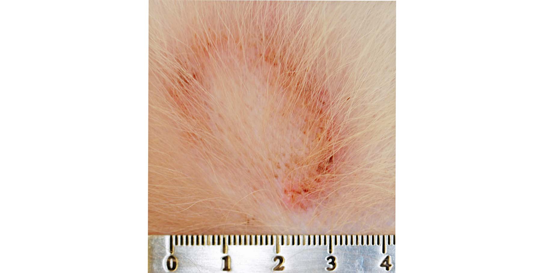 Dermatophytosis (Ringworm) or Superficial Bacterial Infection or Epitheliotropic Lymphoma?