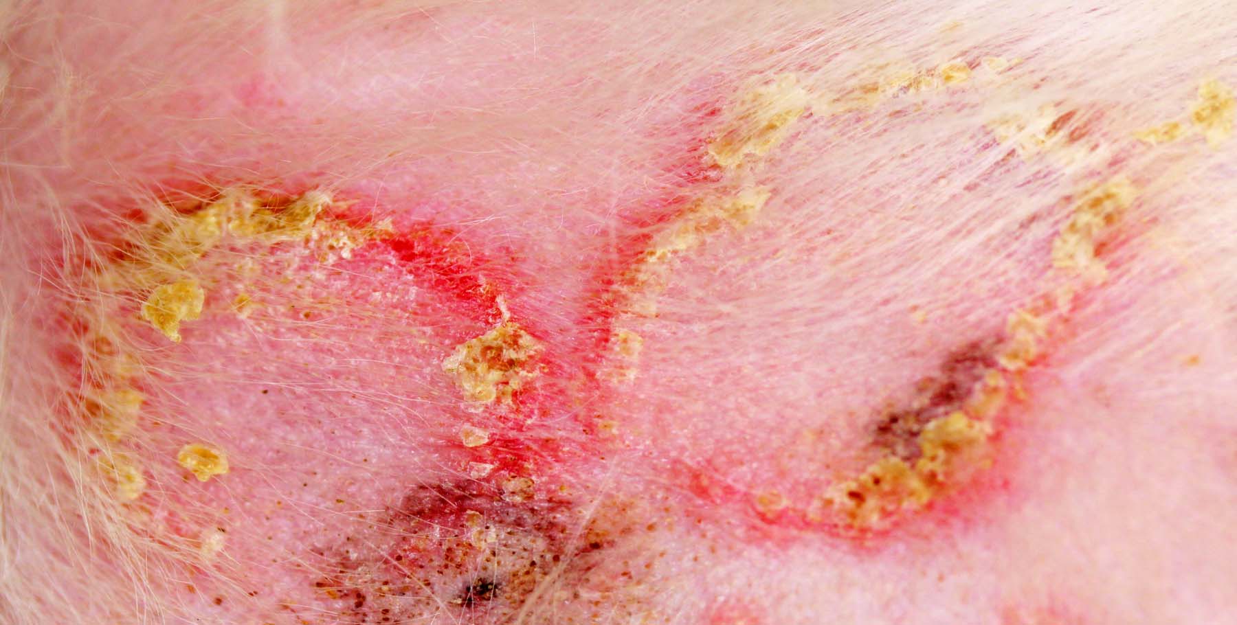 Dermatophytosis (Ringworm) or Superficial Bacterial Infection or Pemphigus Foliaceus