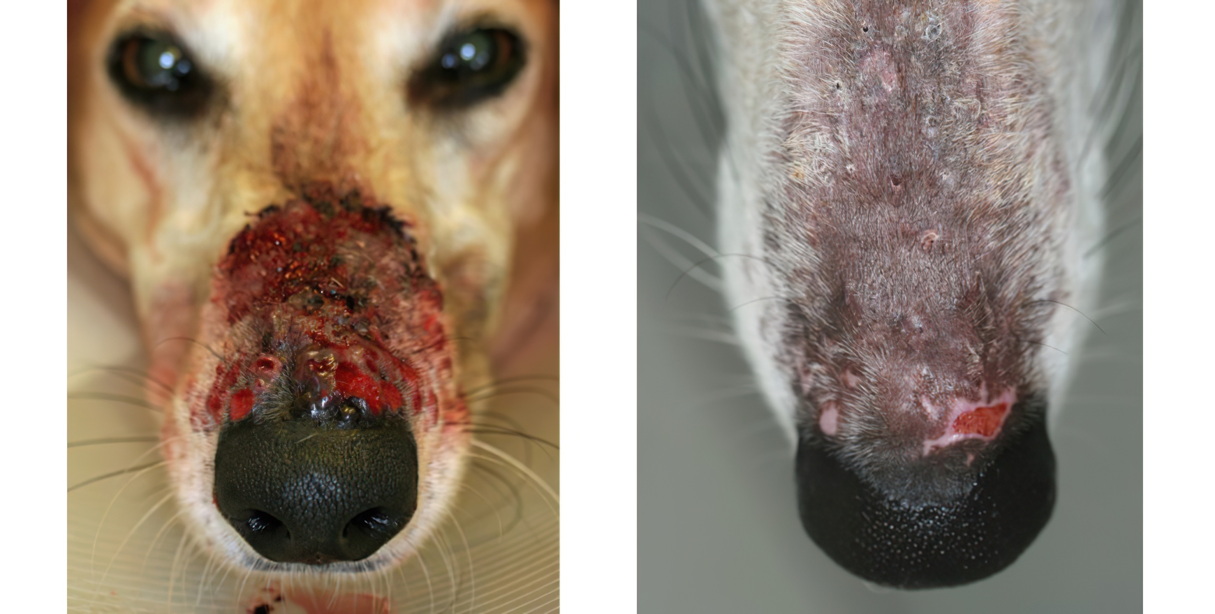 Eosinophilic Folliculitis & Furunculosis (Putative Arthropod-Bite Allergy): before & after 2 weeks Treatment, after immediate Diagnostic Cytology & Cancellation of Biopsy Procedure