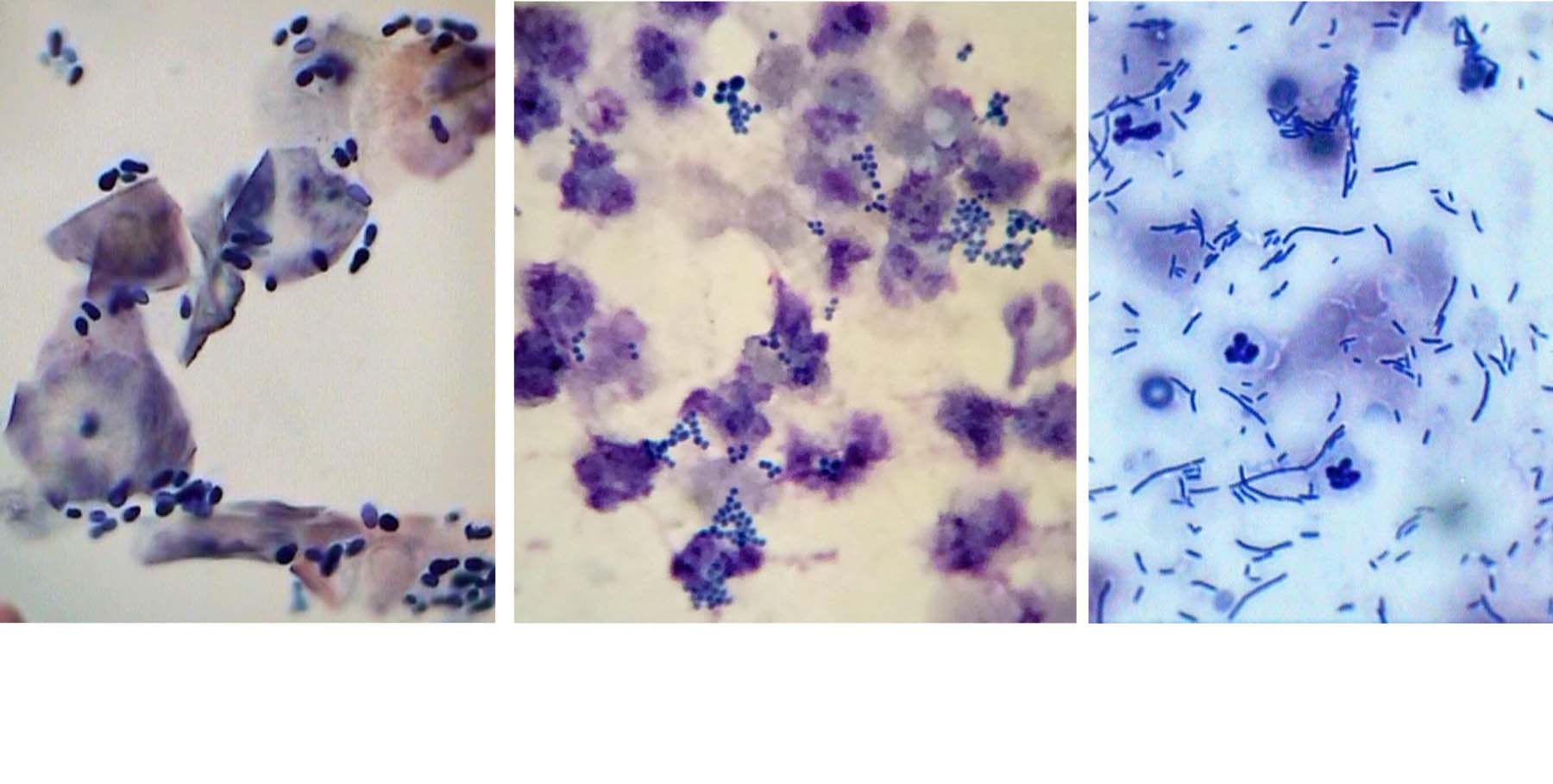 Immediate In-house Otitis Cytology: Malassezia Yeast, Staphylococcal & Pseudomonas Bacteria