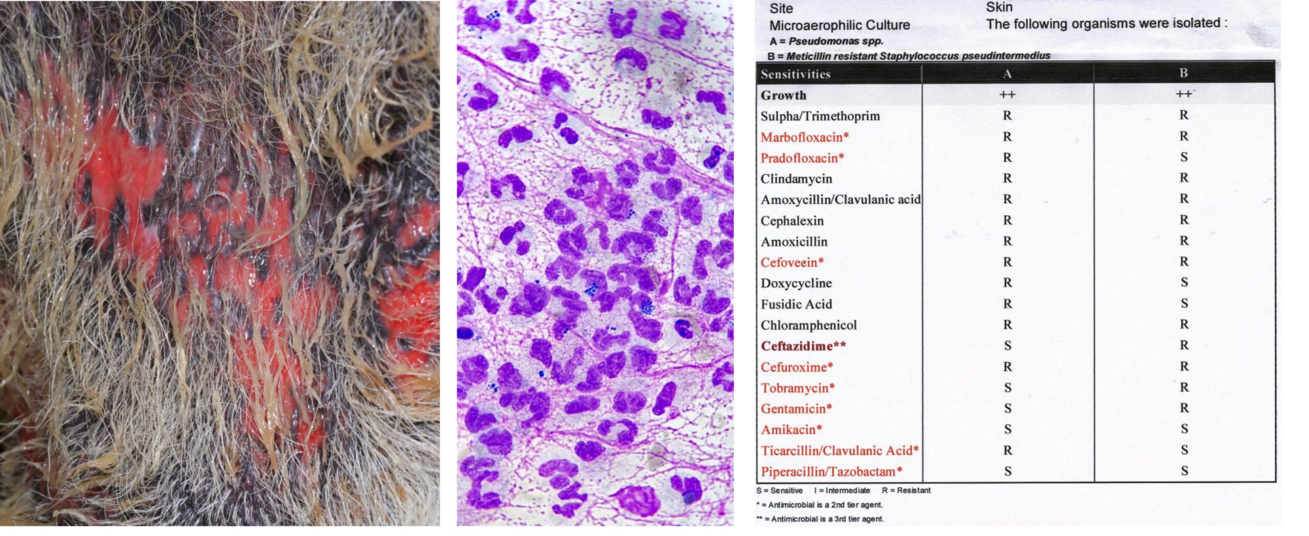 Multi-resistant Staphylococcus Pseudintermedius & Pseudomonas Pyoderma: Cytology & Microbiology Report, German Shepherd Dog