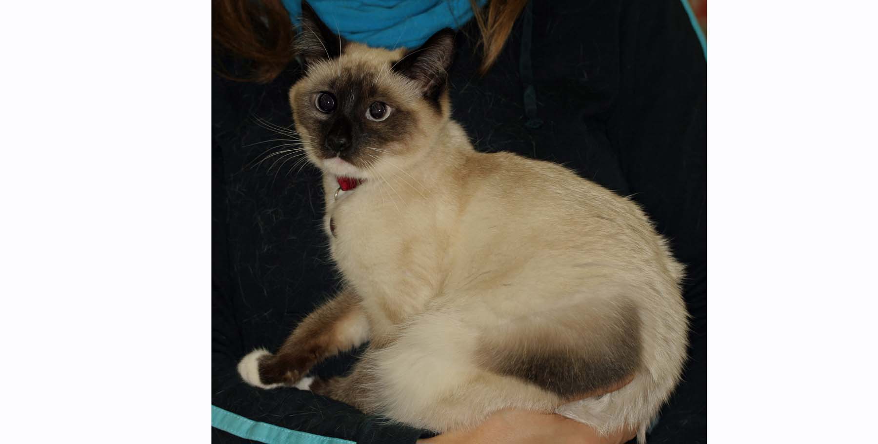 Post-Clipping Melanotrichosis