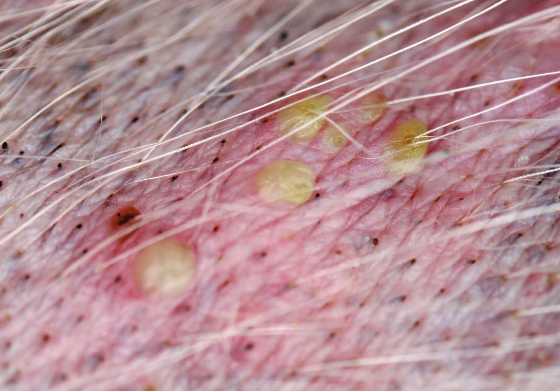 Adult-Onset Generalised Pyodemodicosis: Comedones & Prominent Follicular Pustules