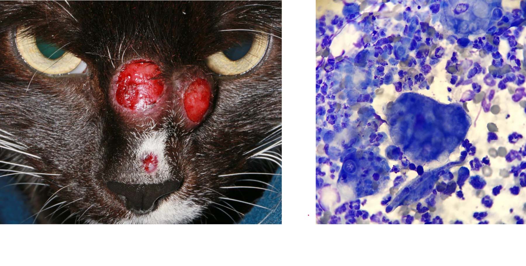 Phaeohyphomycosis: Multifocal, Chronic, Recurrent, Facial, Fungal Granuloma (Alternaria sp.), Fungal Elements on Immediate Cytology