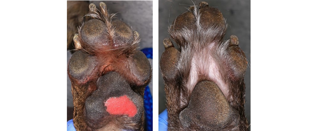 Sloughing Pads: Very Rare, often Fatal, Epidermolysis Bullosa Acquisita, Diagnosis Proposed on Presentation & Cured