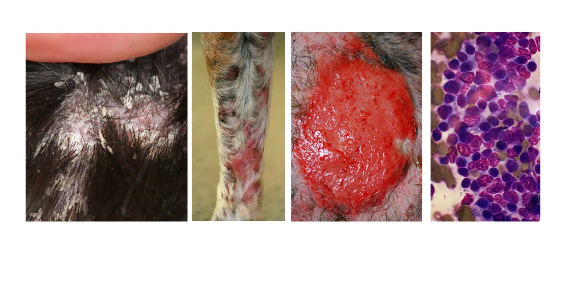 The many faces of Epitheliotropic Lymphoma: Scaling; Alopecia & Erythema; Moist Exudative Plaque plus immediate Diagnostic in-house Cytology
