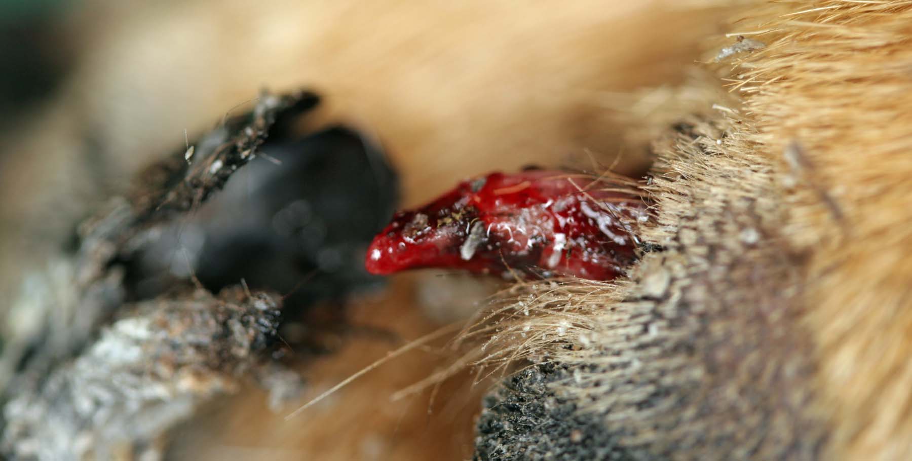 Symmetric Lupoid Onychodystrophy: easily detached claw (onychomadesis)