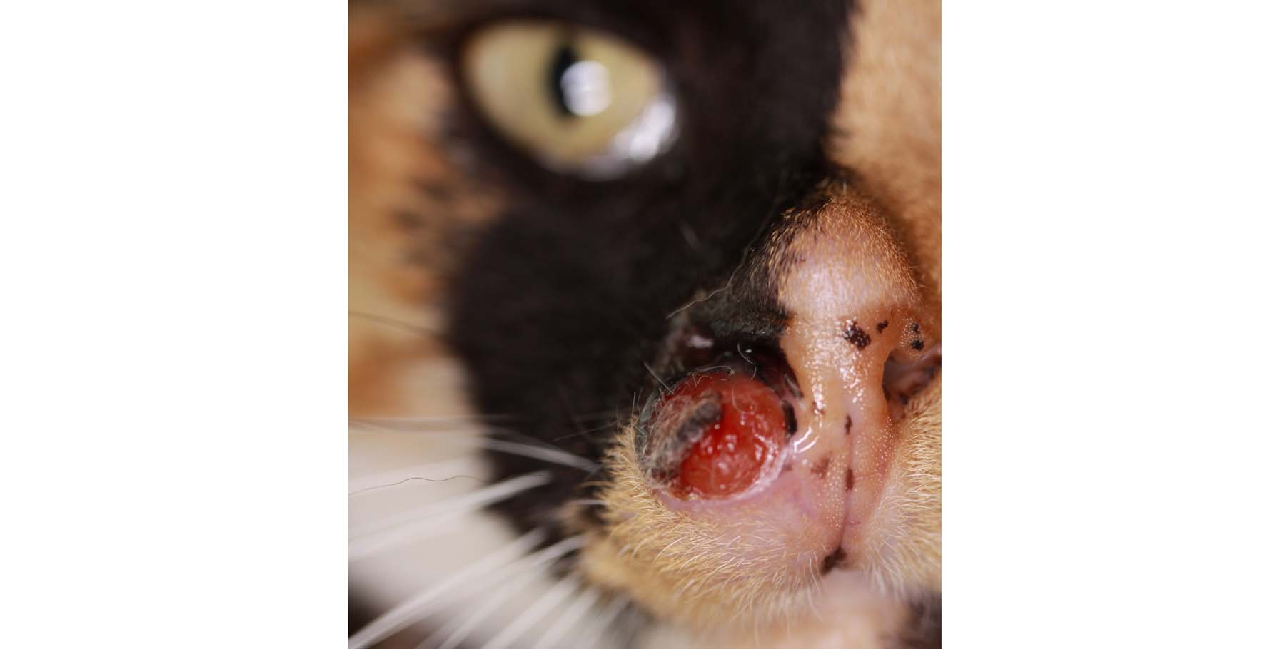 Dermatophytic Kerion: Ulcerated, Focal, Facial, Fungal Granuloma